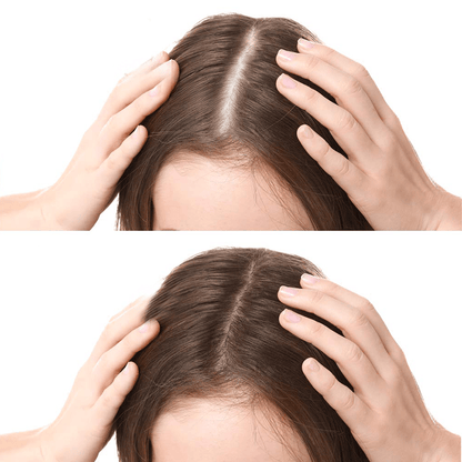 Rootroxy™ FEG plus Hair Growth Spray