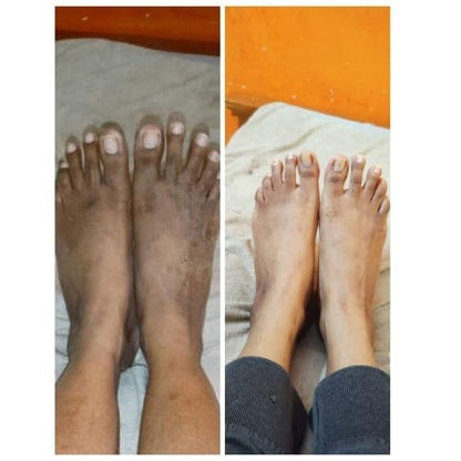 Glowroxy™ Kojic Body Soap (Pack of 3)